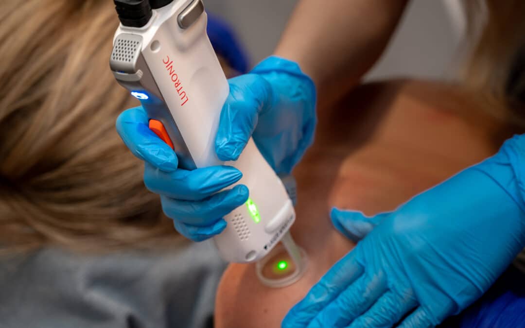 Laser Hair Removal: What to Expect Before, During, and After Treatment
